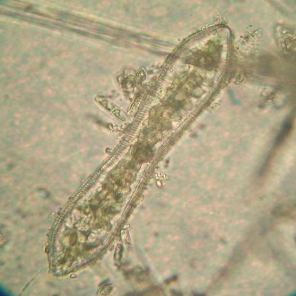 4/ Closterium cf. moniliferum 400x 5b/ Fragilaria sp.