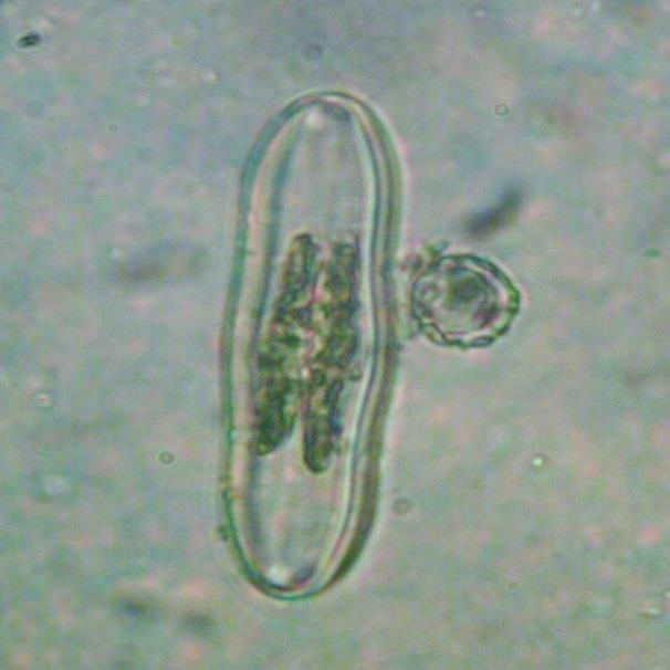 6b/ Cymatopleura cf. librilis, var.