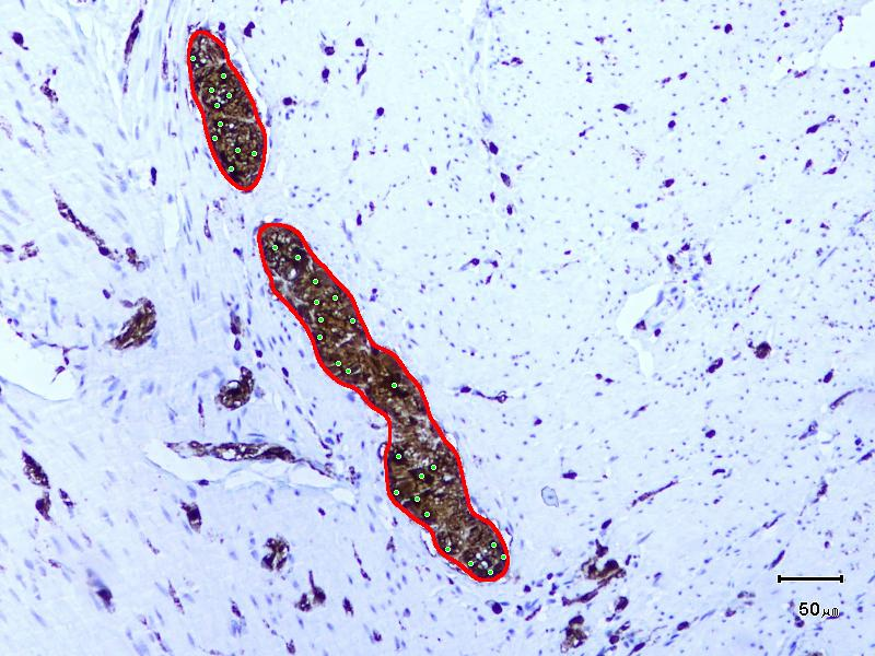 Obr. 19 Výsledek segmentace nervových uzlin ve vybraném mikroskopickém obraze s označením nalezených gliových buněk.