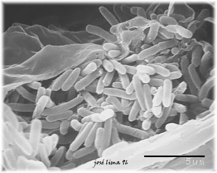 Choulostivé je vůči bakterii Xylella fastidiosa, způsobující zákeřnou Pierceho chorobu, jež se poprvé na jihu Kalifornie objevila v roce 1999, z odrůd révy vinné například Rulandské modré nebo