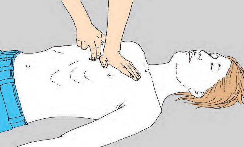 Technika nepřímé masáže srdce Vyhmatá se dolní konec hrudní kosti, dva centimetry nad něj ve střední čáře se přiloží ruka bází dlaně, druhá se přiloží dlaní na její hřbet.