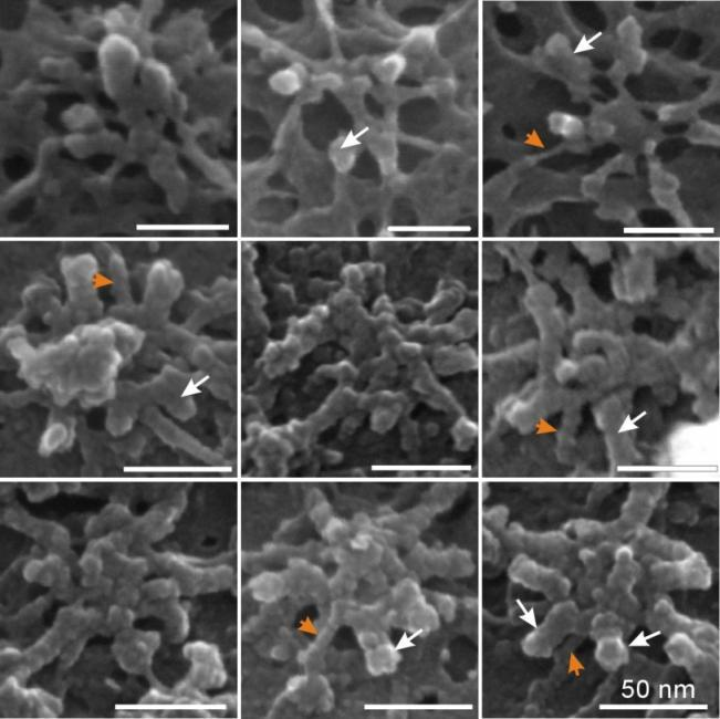 Pohled z cytoplasmy Jaderné póry v buňkách BY-2 Pohled z jádra Xenopus