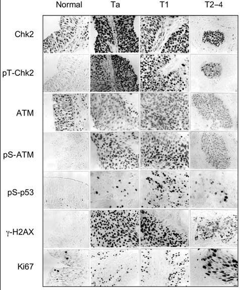 Bártková et al. Nature. 2005, 434(7035):864-70.