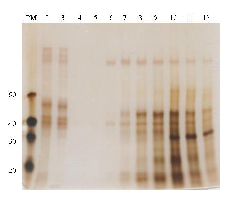 Absorbance UTB ve Zlíně, Fakulta technologická 65 Obr. 8: Chromatografie na měničích kationtů v ph 4 vzorku po 3. extrakci čas [min] P85 P70 P50 P40 P35 P30 Obr.