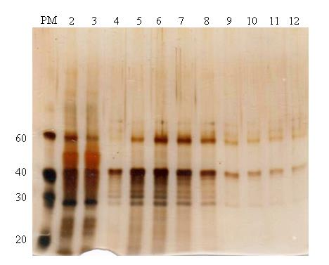 Absorbance UTB ve Zlíně, Fakulta technologická 68 Rozdíl mezi provedením anexové chromatografie v ph 8 a 10 nebyl příliš výrazný, v ph 10 však lze pozorovat větší množství málo zastoupených proteinů,