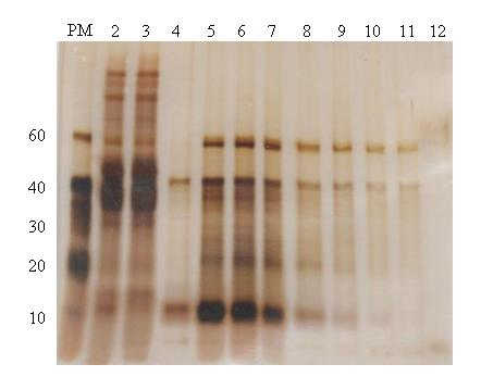 Absorbance UTB ve Zlíně, Fakulta technologická 69 čas [min] Obr. 15: Chromatografie na měničích aniontů v ph 10 vzorku po 2. extrakci P60 P41 P10 Obr. 16: Tricinová elektroforéza vzorku po 2.