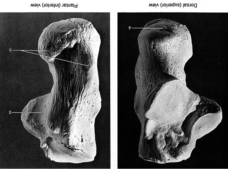 Calcaneus patní kost Je největší a nejmasivnější z kostí nohy. V kostře nohy tvoří zadní a dolní oddíl, který přejímá část hmotnosti těla z kosti hlezenní a přenáší ji na podložku.