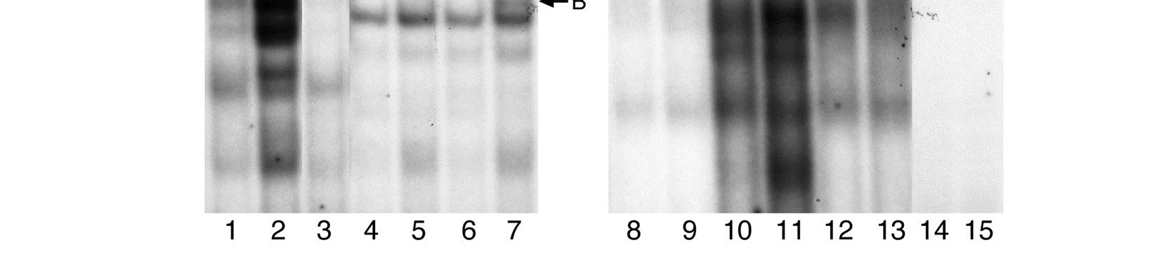 K určení, zda se mohou proteiny vázat na fragmenty DNA obsahující polymorfizmy - 432C T a 86insC jsme použili EMSA.