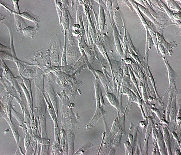 8 Výsledky 8.1 Kultivace HLhT1 buněk Buňky HLhT1 kultivované v KNAC-10% FBS médiu vytvářely jednoduchou monovrstvu buněk protáhlého tvaru, zejména při nižších hustotách buněk (Obr. 5).