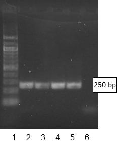 6.5.1 Stanovení velikosti amplikonů Graf 6-1 Závislost délky fragmentů (bp) na mobilitě (cm) Amplikony měly velikost 250 bp. 6.5.2 Detekce produktů PCR pomocí agarózové gelové elektroforézy Pomocí agarózové gelové elektroforézy byla provedena detekce produktů PCR (viz obrázek 6-2).