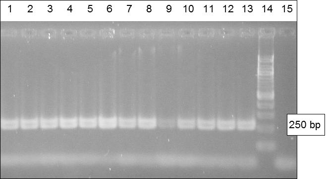 Největší množství DNA bylo izolováno hypersíťovanými magnetickými mikročásticemi (vzorky ME1, ME2) resp. částicemi MPG Uncoated a Fkol-135ox (vzorek ME3).