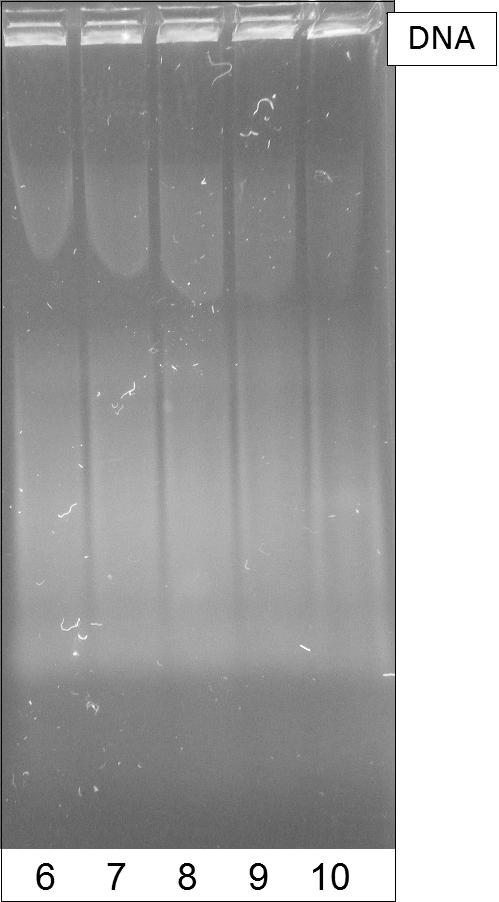 Obrázek 8-1 Agarózová gelová elektroforéza hrubého lyzátu buněk (HL4.1 HL8.1) Obrázek 8-2 Agarózová gelová elektroforéza hrubého lyzátu buněk (HL9.1 HL13.