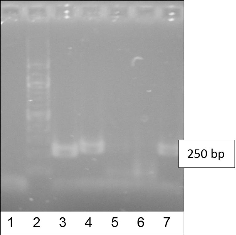 Obrázek 11-4 Agarózová gelová elektroforéza produktu PCR (250 bp) Tabulka 11-4 Vyhodnocení průběhu PCR (doplněk stravy Linex Forte) Běh Popis Detekce PCR produktu 1 Negativní kontrola - 2 Žebříček