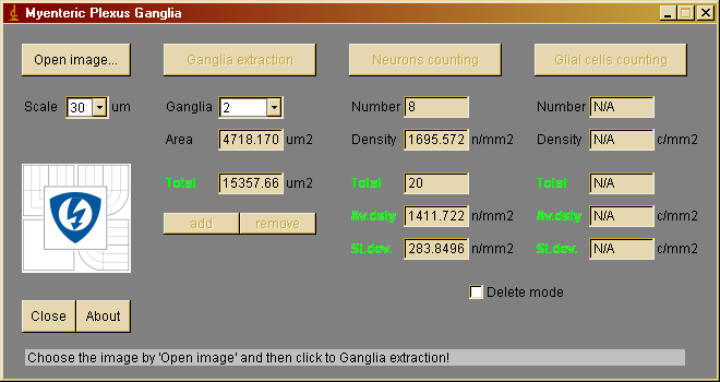 obrazů. Pro prostředí ImageJ byly vytvořeny dva plug-in moduly. Okno vybraného plug-in modulu pro zpracování mikroskopických obrazů nervových uzlin střevní stěny lze vidět na obr. 17.