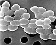 2.5.2 Čeleď Enterococcaceae ENTEROCOCCUS FAECALIS - čeleď Enterococcaceae Grampozitivní, nesporulující, anaerobní bakterie. Kokovité, oválné buňky.