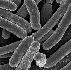 Tyčinkovité buňky. 2,0-6,0 x 1,1-1,5 µm. Výskyt u dospělých jedinců obr.č. 7 Escherichia coli http://www.freedrinkingwater.com/watercontamination/ecoli-bacteria-removal-water.