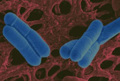 LACTOBACILLUS SALIVARIUS čeleď Lactobacilaceae Grampozitivní, nesporulující, tyčinkovité bakterie obr.č. 14 Lactobacillus salivarius http://www.