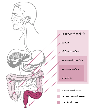 VLIV PROBIOTIK PŘI PRŮJMECH ZPŮSOBENÝCH CHRONOVOU CHOROBOU BAKTERIÁLNÍ KMEN/ ČÍSLO STUDIE DÁVKA/DENNĚ/DÉLKA STUDIE VÝSLEDEK ESCHERICHIA COLI 5 x10;:/1xdenně/rok PRODLOUŽENÝ ÚSTUP POTÍŽÍ SACCHAROMYCES