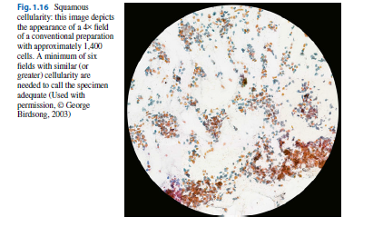 ( 250 000 ) LBC ( liquid based cytologie) : 5 000 bb.