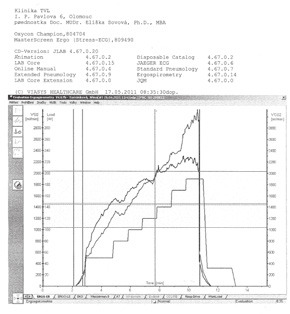 Vyšetřovací metody v kardiologii 2 Obr. 3 Spiroergometrie výsledek vyšetření Křivky spotřeby O 2 a výdeje CO 2. 2.3.4 Test chůze 6minutový Provedení tohoto testu je velmi jednoduché.