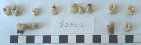 Zachovány korunky zubů, kořen zachován pouze u P1 dolní (přítomen zubní kámen) a porušený kořen také u M1 pravá dolní. Dále zachováno několik fragmentů zubní skloviny korunky. Celkem nalezeno 14 zubů.