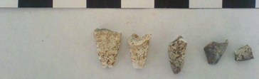 1961 a stupně mineralizace zubů M1 stádium VII, P VII a M3 stádium IV ukazuje na věk 14-16
