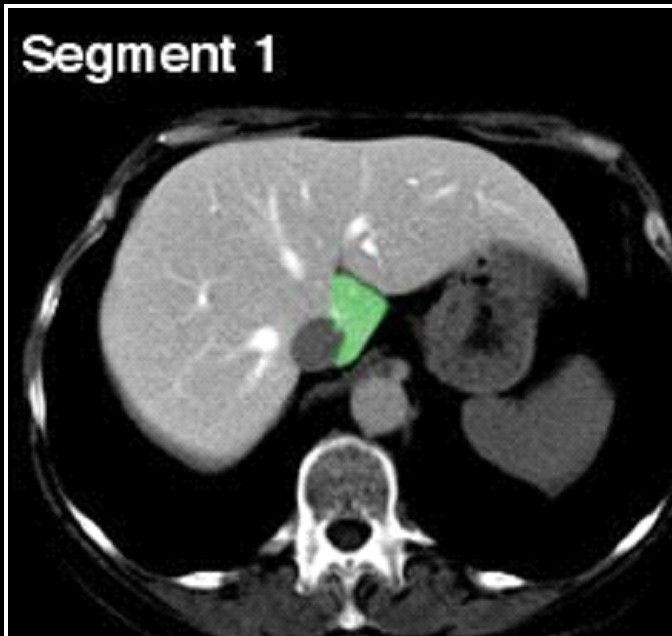 segment I,