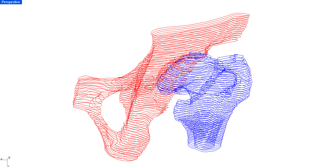 Proximální část stehenní kosti byla modelována pomocí získaných CT řezů. Řezy byly opět minimálně upraveny pro hladkost hlavice a pro bezproblémovou tvorbu konečnoprvkového modelu.