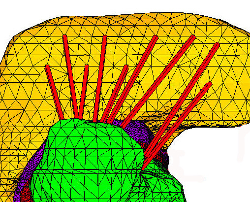 Obr.10.8. Model geometrie použitých svalů ve výpočtovém modelu 10.2.5.