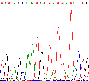 A A/G Obr. 16 Sekvenace 2. exonu N-RAS genu mutace Q61R a) bez mutace, b) mutace Q61R (CAA/CGA) T T/C Obr. 17 Sekvenace 1.