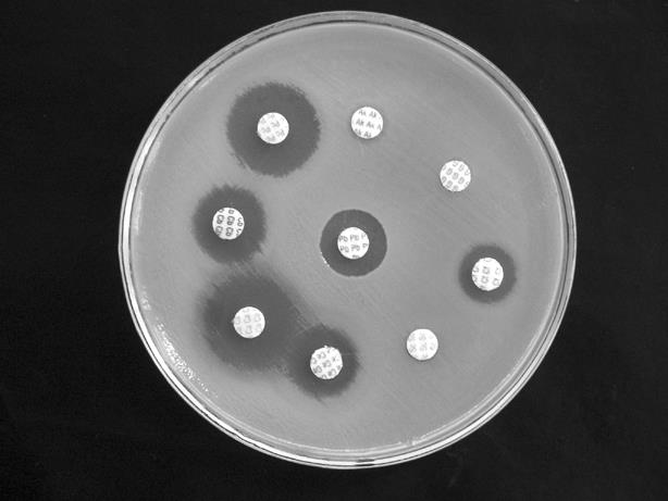 stanovení citlivosti k ATB testy kvalitativní výsledek nám říká, zda je antibiotikum účinné nebo je kmen rezistentní (neměří stupeň citlivosti) disková difuzní metoda spočívá v difúzi ATB do agaru s