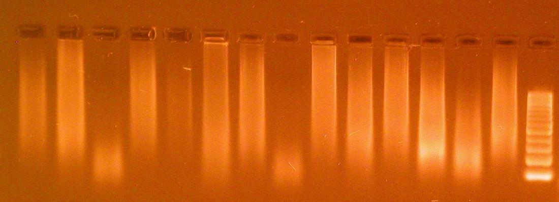 DNA kvalita a kvantita Preanalytická