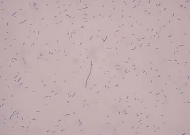 D) CZE separace bakterie Lactobacillus acidophilus SEMIPREPARACE 500 400