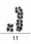 11 mfish: 33~45,XY,der(1)t(1;12)(q12;q13),der(3)t(3;18)(p12;q11),