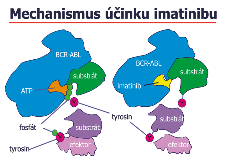 Obr. 1. Mechanizmus účinku imatinibu; selektivní blokování leukemické tyrozinkinázy imatinibem. Vlevo situace před podáním léku, vpravo po podání léku.