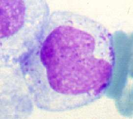 nucleoli Basophilic cytoplasm Absence of granules (and Auer rods)