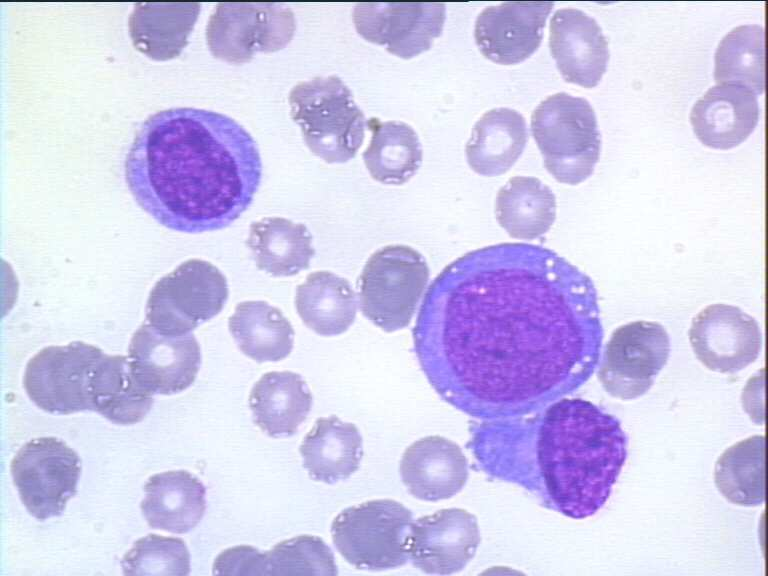 Monoblasts: large round or slightly indented nucleus very loose, spongy, reticular and homogeneous