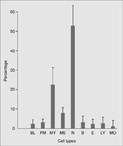 Chronická myeloidní leukémie t(9;22) a/nebo BCR/ABL pozitivní Periferní krev (chronická fáze): leukocyty zmnoženy, medián cca 170 G/l, neutrofilie, všechna vývojová stadia, dva vrcholy - segmentované