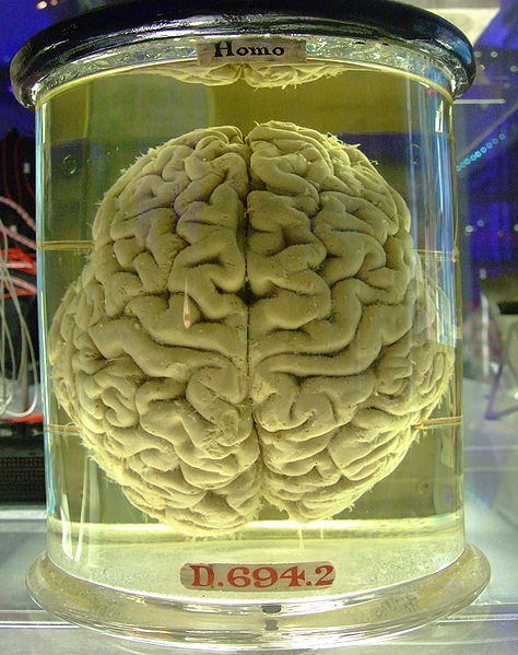 Ľudský mozog Tri hlavné časti: veľký mozog mozoček mozgový kmeň Lebka, mozgomiešna tekutina, zvrásnenie Nervové bunky a nervové