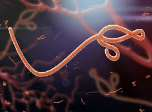 Ebola-příznaky Prodromální stadium připomínající klasickou virózu- náhlá horečka, slabost, bolesti svalů a kloubů, bolest v krku Následuje zvracení, průjem, vyrážka,