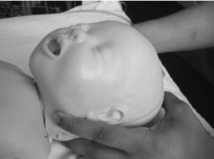 KPR novorozenců po porodu Optimální poloha hlavy?