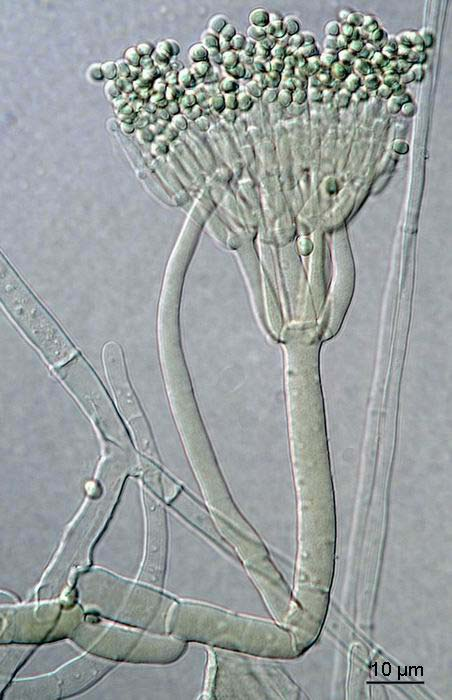 Gliocladium viride