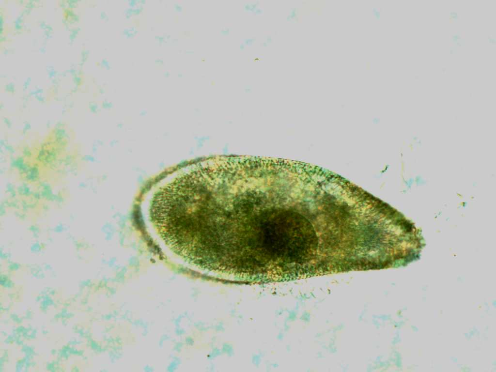 Obrázek 28: Trepka velká (Paramecium caudatum) - methylová zeleň - jádro.