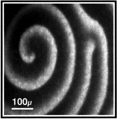 Obrázek 7: Spirálová vlna oocytu drápatky vodní. Světlejší místa značí vyšší koncentraci Ca 2+. http://iops