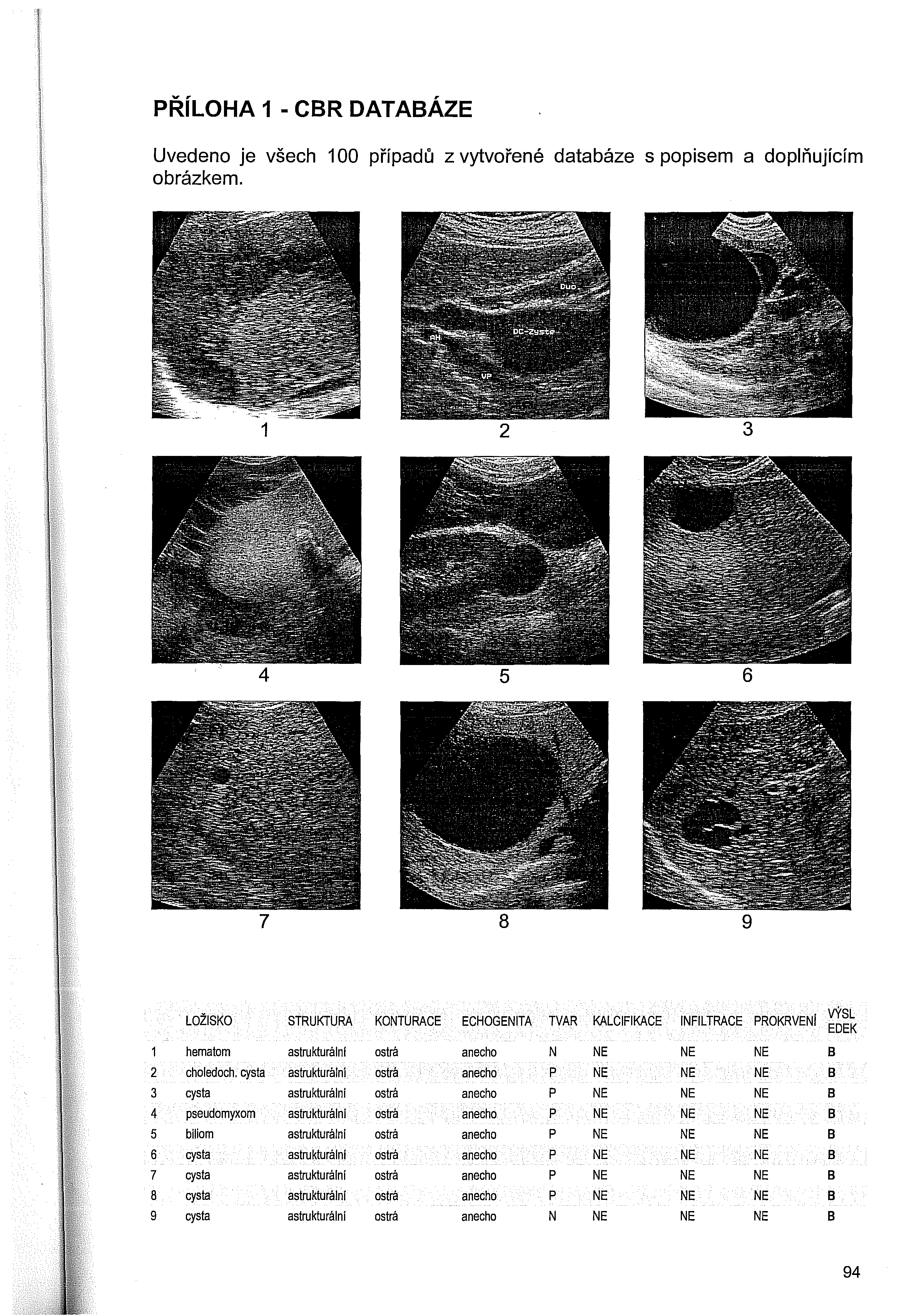 PŘÍLOHA 1 - CBR DATABÁZE Uvedeno je všech 100 případů z vytvořené databáze s popisem a doplňujícím obrázkem.