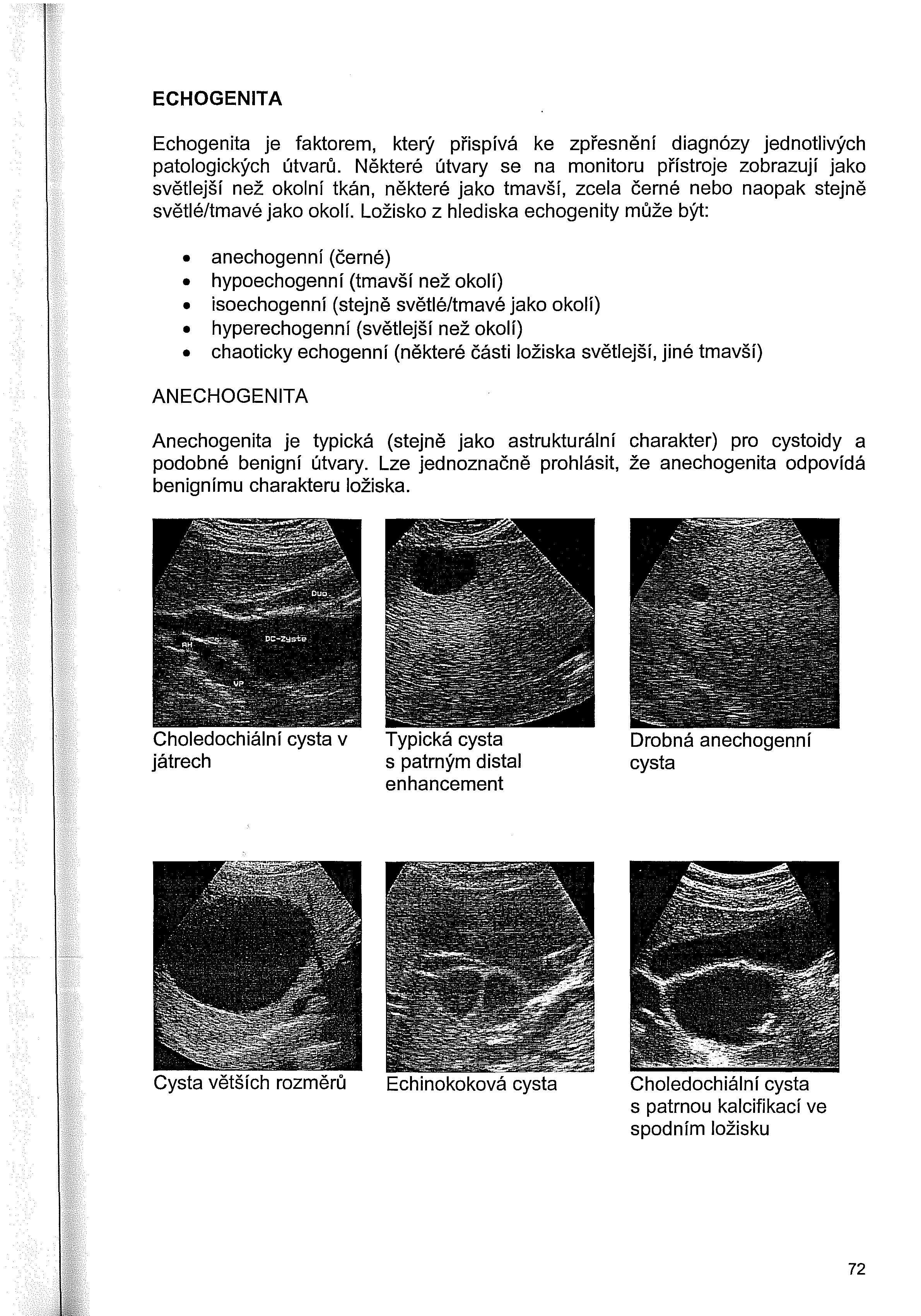 ECHOGENITA Echogenita je faktorem, který přispívá ke zpřesnění diagnózy jednotlivých patologických útvarů.