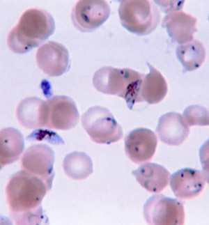 Obr. č.5 : plasmodium přítomné v krevním nátěru Zdroj: http://www.labspaces.net/98777/vaccine_blocks_malaria_transmission_in_lab_experiments 3.5.9. Změny v genetické výbavě komára V roce 2003 vytvořil americký tým vědců prvního geneticky modifikovaného komára.