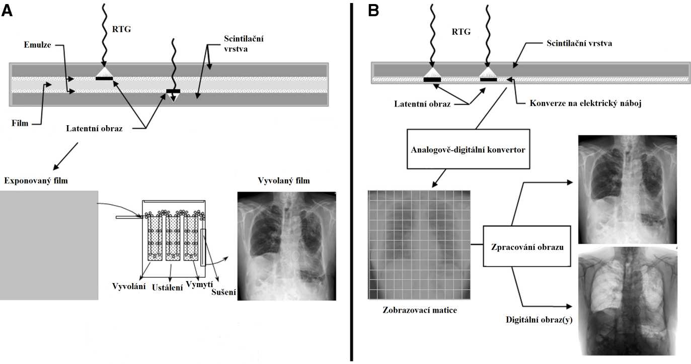 RADIOGRAFICKÝ FILM nejrozšířenější typ analogového detektoru folie z fluorescentního materiálu -> emise viditelného světla -> latentní obraz -> chemické zpracování DETEKTORY INTEGRUJÍCÍ NÁBOJ převod