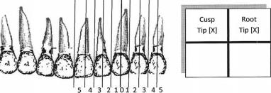 3.4.4.9.2 KPG index V roce 2009 byl vyvinut KPG index, což je nová metoda v klasifikaci a určení obtížnosti léčby retinovaných špičáků na CBCT, bez použití složitých měření vzdáleností a úhlů [3].