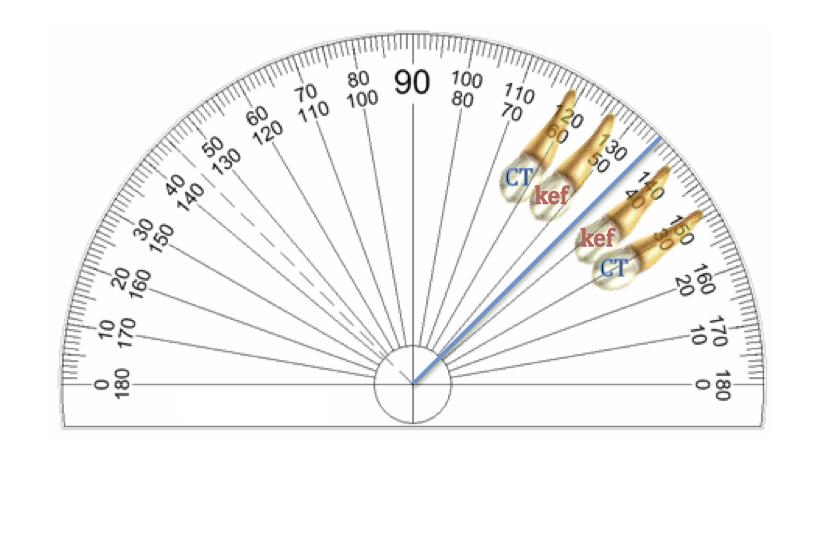 CBCT Gen kef kef 1,7º 2,7º Obr. č. II/40: Soustavná chyba v reprodukovatelnosti měření na digitálních rentgenogramech. OL Obr. č. II/41: Čím je stupeň sklonu špičáku k okluzní linii na CBCT menší (špičák je horizontálněji skloněn), tím je na planárním kefalometrickém snímku jeho hodnota větší.